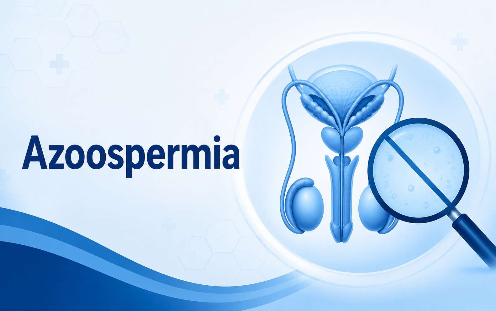 Azoospermia