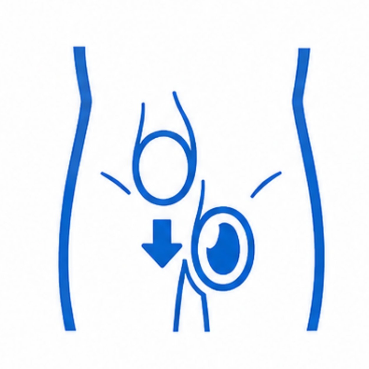 img of Undescended Testis