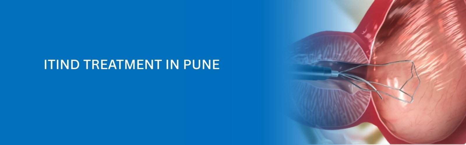 iTIND-Treatment-in-Pune