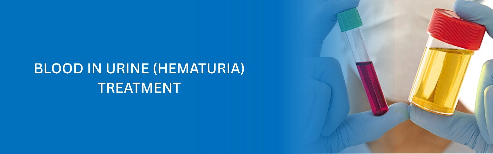Blood in Urine (Hematuria) Treatment banner